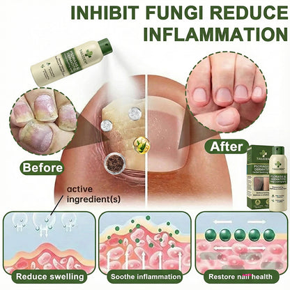 🔥𝗙𝗶𝗻𝗮𝗹 𝟯 𝗛𝗼𝘂𝗿𝘀: 𝟴𝟬% 𝗢𝗙𝗙:𝗧𝗔𝗜𝗟𝗘𝗗𝗘𝗡® 𝗠𝗮𝗴𝗻𝗲𝘀𝗶𝘂𝗺 𝗛𝗲𝗿𝗯𝗮𝗹 𝗣𝘀𝗼𝗿𝗶𝗮𝘀𝗶𝘀 𝗦𝗽𝗿𝗮𝘆