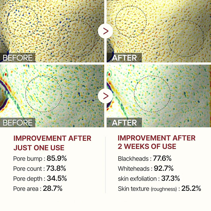 [𝗧𝗔𝗜𝗟𝗘𝗗𝗘𝗡® Official] Peel Shot Glow Rice Ampoule Duo - Serums for Brightening, Exfoliating, and Moisturizing - Suitable for All Skin Types